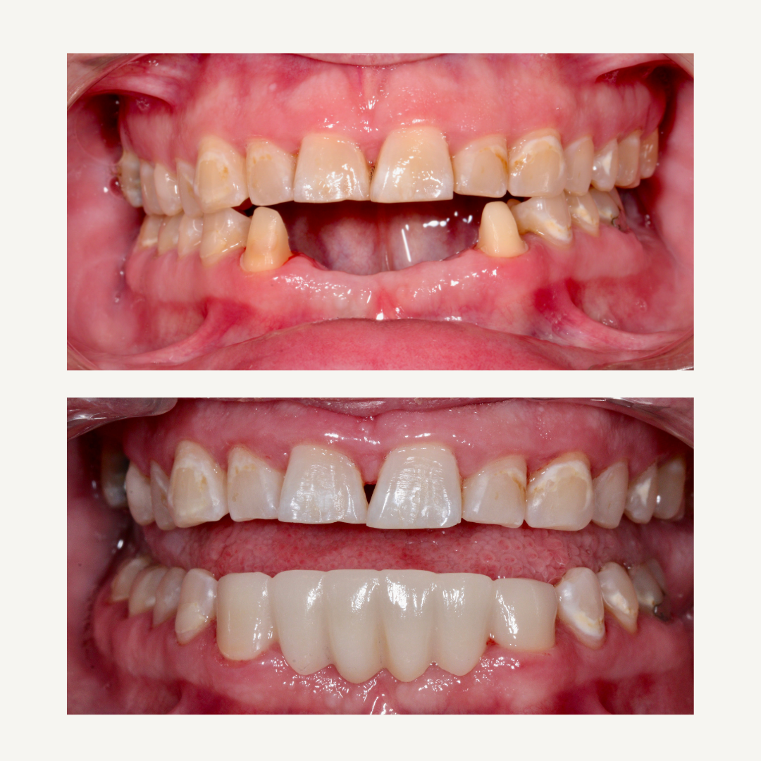Beige Brown Neutral Before + After Instagram Post (1) Beige Brown Neutral Before + After Instagram Post (1)