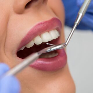 Teeth being examined at dentist