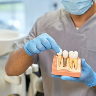 Dentist showing anatomy of dental implant