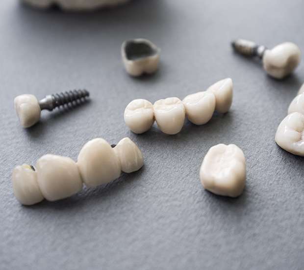 Cornelius The Difference Between Dental Implants and Mini Dental Implants